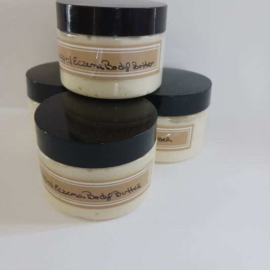 Whipped Eczema Body Butter